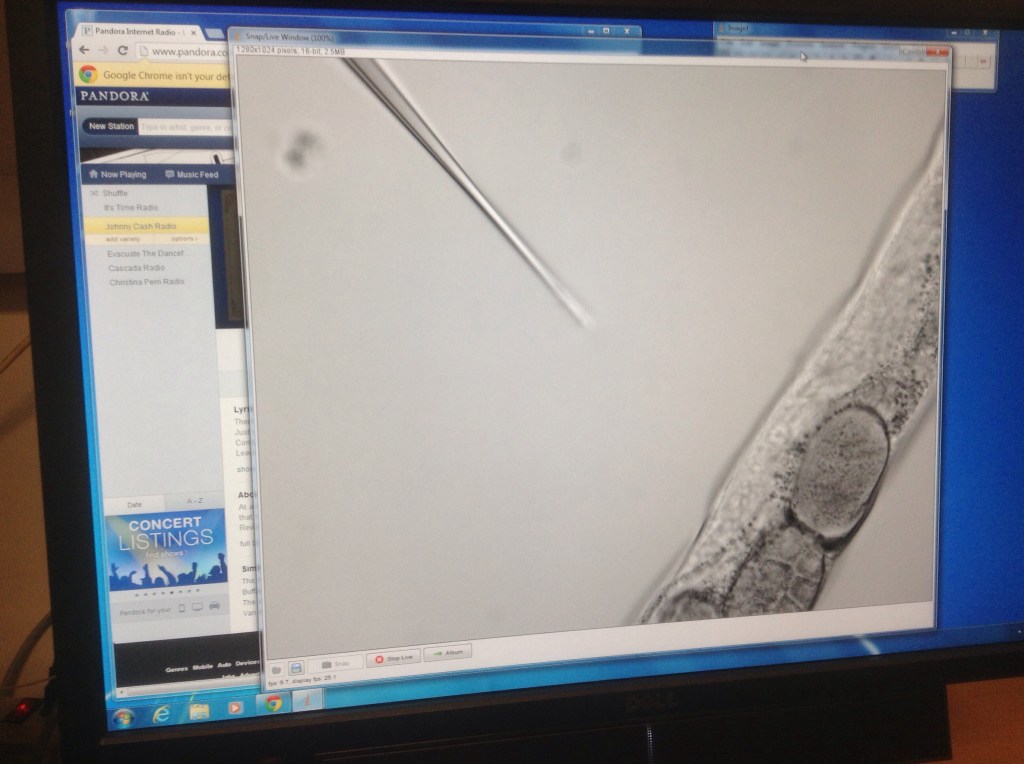 This is what my computer captures under my microscope when I inject a worm.